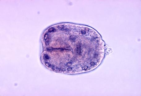 Hydatide (forme larvaire) du tænia Echinococcus granulosus. Sous forme larvaire ce parasite peut provoquer une hydatidose